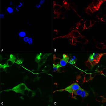 GABA A Receptor Antibody