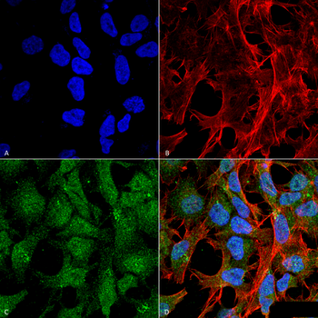 UVRAG Antibody (Biotin)