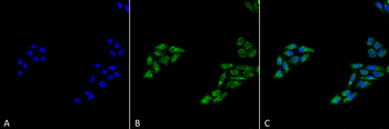 p53 Antibody (FITC)