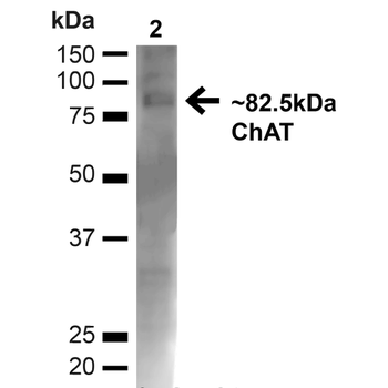 Choline Acetyltransferase Antibody (APC)