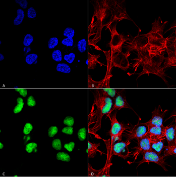 Choline Acetyltransferase Antibody (HRP)
