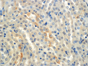 ENaC alpha Antibody (APC)