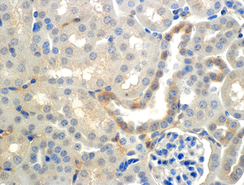 ENaC beta Antibody (FITC)