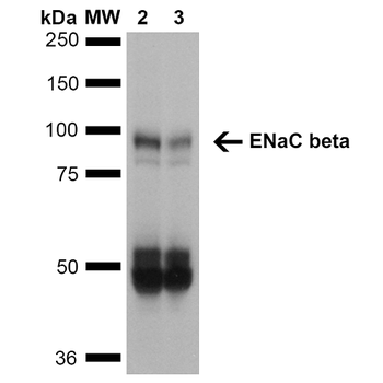 ENaC beta Antibody (PerCP)