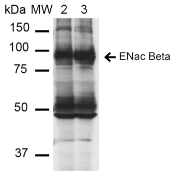 ENaC beta Antibody (PerCP)