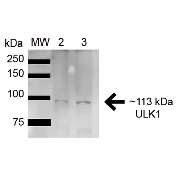 ULK1 Antibody (APC)