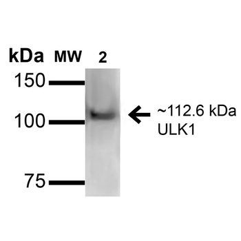 ULK1 Antibody (APC)