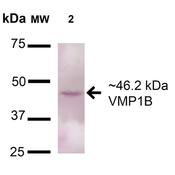 VMP1 Antibody (HRP)