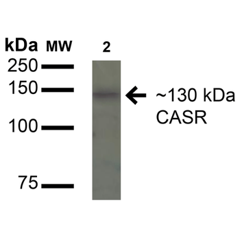 Calcium Sensing Receptor Antibody (APC)