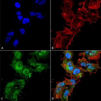 Calcium Sensing Receptor Antibody (FITC)