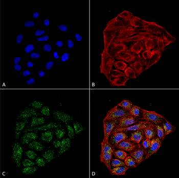CD74 Antibody (FITC)