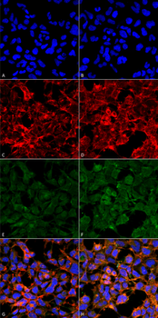 Malondialdehyde Antibody (Biotin)