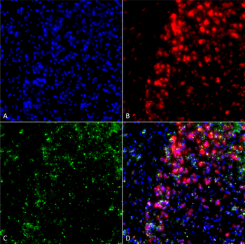 Alpha Synuclein Antibody (Biotin)