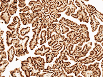 Wnt5a Antibody (HRP)