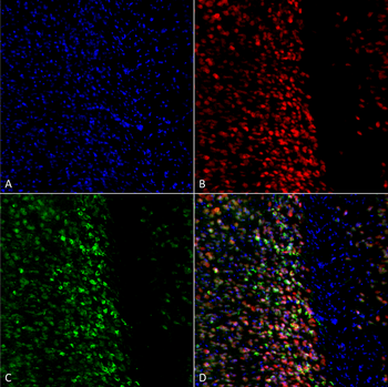Alpha Synuclein (pSer129) Antibody (Biotin)