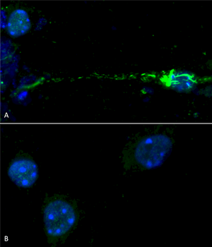 Alpha Synuclein (pSer129) Antibody (HRP)