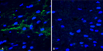 Alpha Synuclein (pSer129) Antibody (RPE)