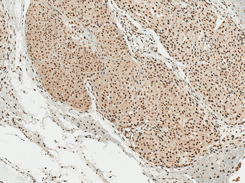 Alpha Synuclein (pSer129) Antibody (RPE)