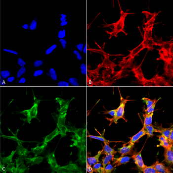 HSP70 (Acetyl Lys77) Antibody (FITC)