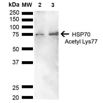 HSP70 (Acetyl Lys77) Antibody (FITC)