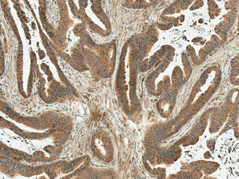 MDM2 Antibody