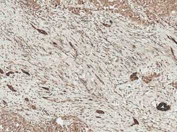 LRP1 Antibody