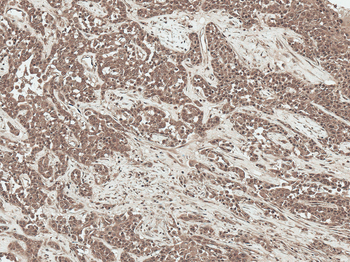 SFRP2 Antibody (FITC)