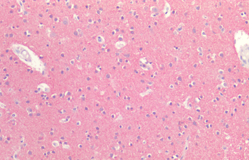 Tau Antibody (HRP)