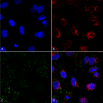 HSP70 Antibody (RPE)