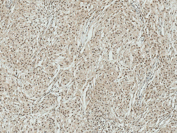 ATG7 Antibody (PerCP)