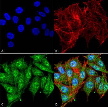 IGF-1 Antibody (Biotin)