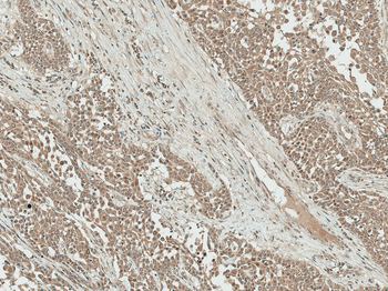 IGF-1 Antibody (HRP)