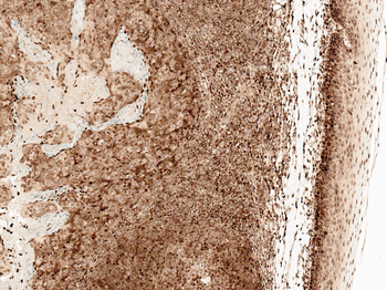 CCR2 Antibody (HRP)