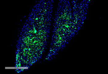 Thyroid Hormone Receptor Antibody (APC)