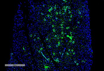 parvalbumin Antibody (APC)