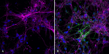 Alpha Synuclein (pSer129) Antibody (FITC)