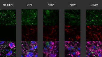 Alpha Synuclein (pSer129) Antibody (HRP)