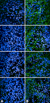 Tau (pSer202/ pThr205) Antibody