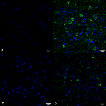 Tau (pSer202/ pThr205) Antibody