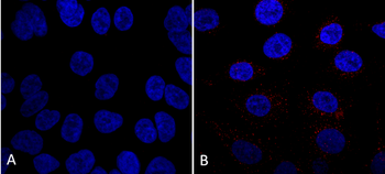 VPS35 Antibody (FITC)
