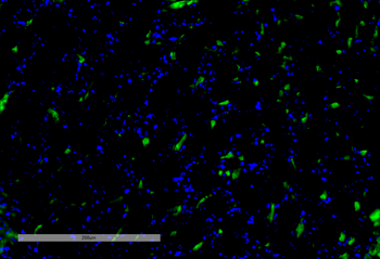 VPS35 Antibody (APC)