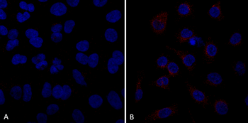 VPS35 Antibody (FITC)