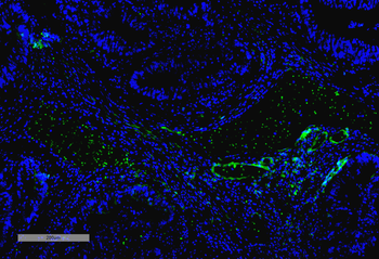 VPS35 Antibody (RPE)