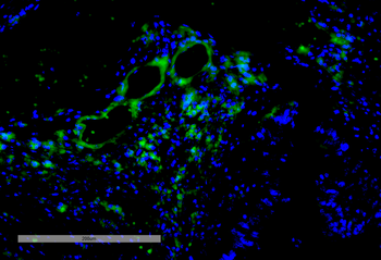 VPS35 Antibody (APC)