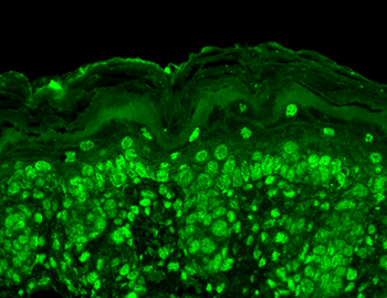 CavBeta2 Antibody