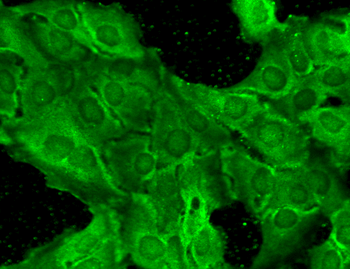 NR2B Antibody