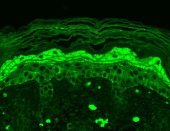 NR2B Antibody