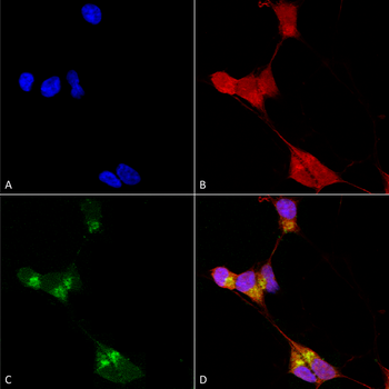GABA A Receptor Antibody