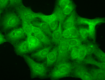 GABA A Receptor Antibody
