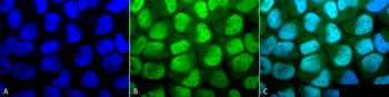 Methylated Lysine Antibody (HRP)